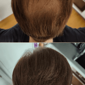 Gofybr 7g free sample — customer hair thickening before and after