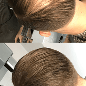 Gofybr 7g free sample — customer hair thickening before and after