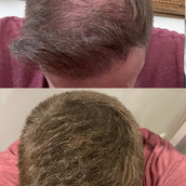 Gofybr 7g free sample — customer hair thickening before and after