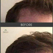 Gofybr 84g Hair Thickening Fibres Instant Results - 180 day supply