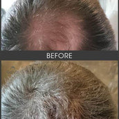 Gofybr 28g Hair Thickening Fibres Instant Results - 60 day supply