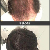 Gofybr 14g - 30 days supply